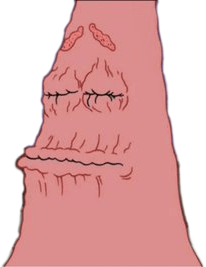 :dry-patrick: